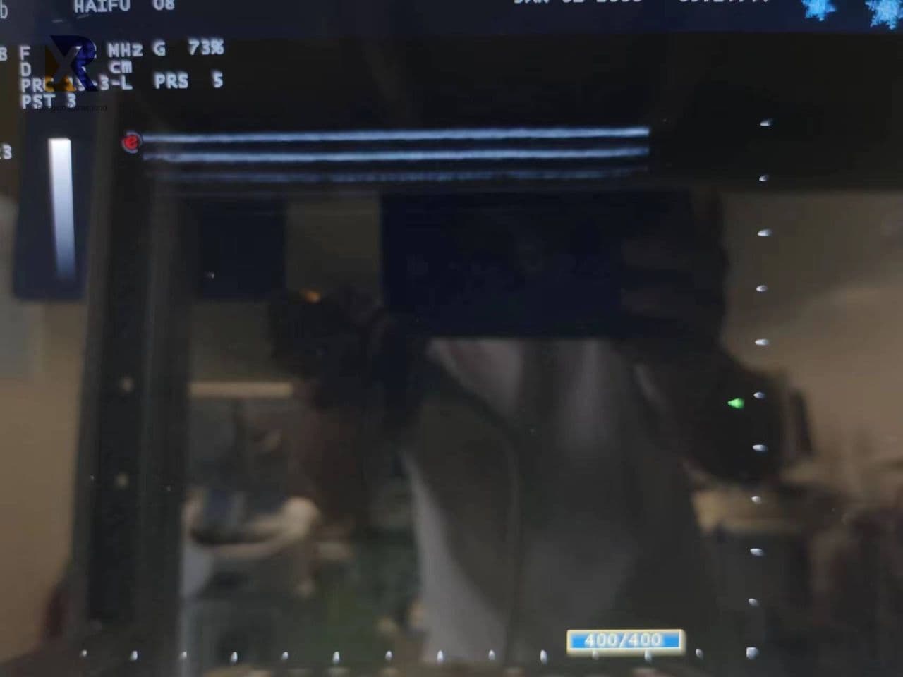 Biosound Esaote LA523 Linear Array Ultrasound Transducer thumbnail 3