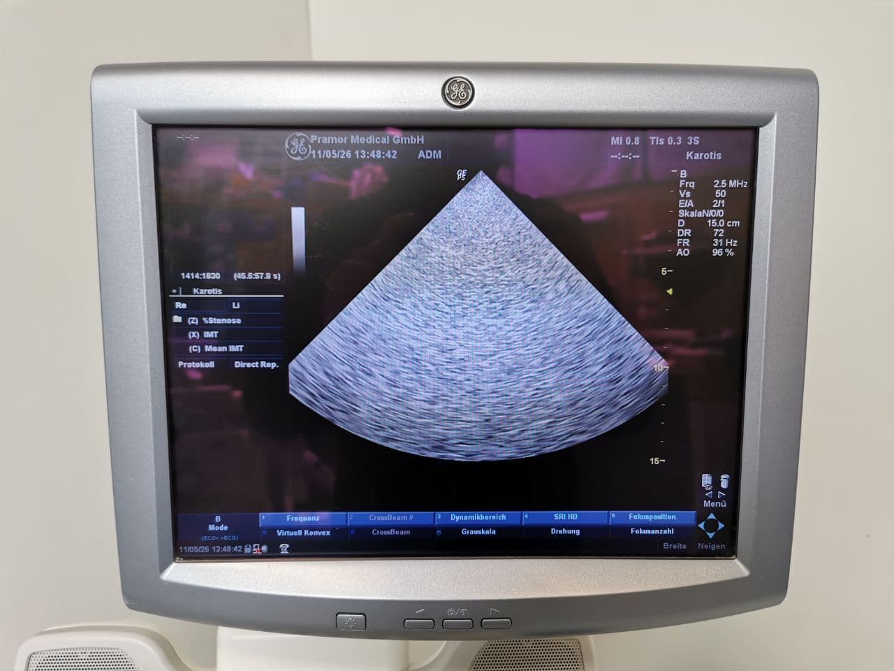 LOGIQ P5 General Purpose Ultrasound System by GE Healthcare thumbnail 8