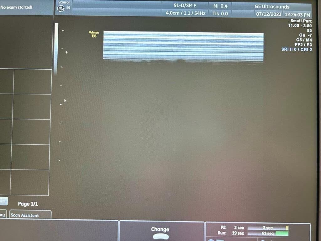 GE 9L-D Linear Array Ultrasound Transducer thumbnail 2