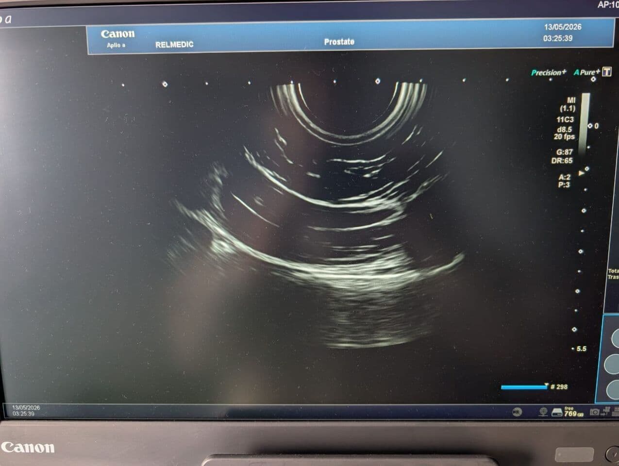 Toshiba Aplio A Diagnostic Ultrasound System thumbnail 11