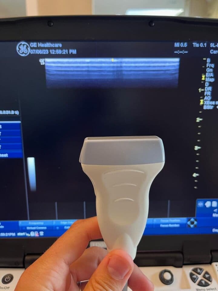 GE 9L-RS Linear Array Ultrasound Probe image 1