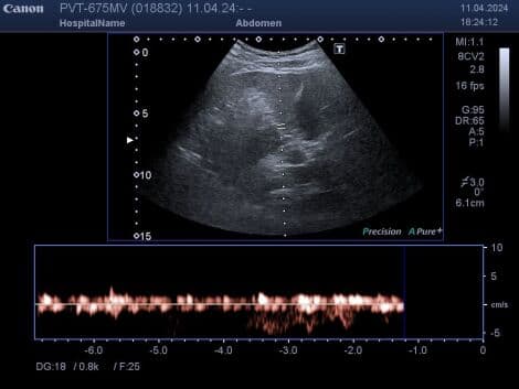 Toshiba PVT-675MV 3D/4D Convex Ultrasound Transducer thumbnail 4