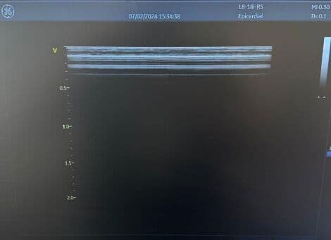 High-Frequency Linear Ultrasound Probe — GE L8-18i-RS for Vascular and Small Parts thumbnail 5