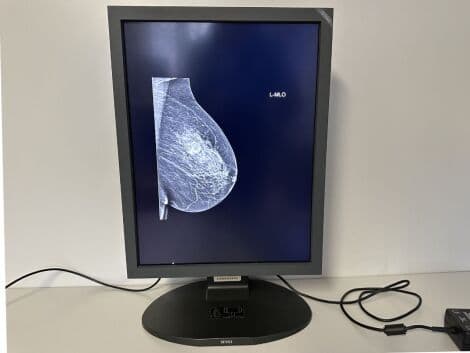 Totoku ME315L / MDL2105A Diagnostic Display Monitor thumbnail 3