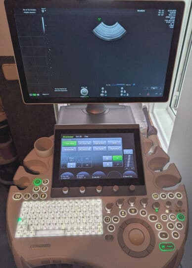 GE Voluson E8 OB/GYN Ultrasound System thumbnail 7