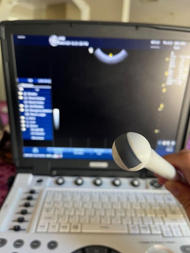 GE E8C-RS Endocavitary Ultrasound Transducer