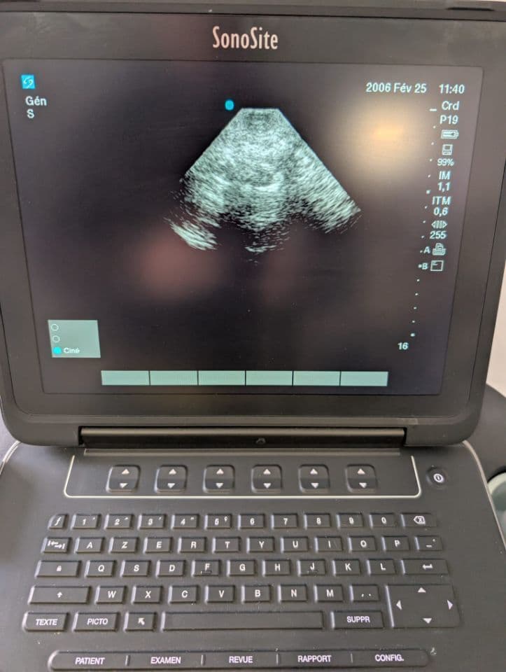 Sonosite rP19x Cardiac Ultrasound Transducer Probe thumbnail 8
