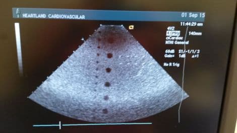 Acuson 4V2 Vector Array Ultrasound Transducer thumbnail 3