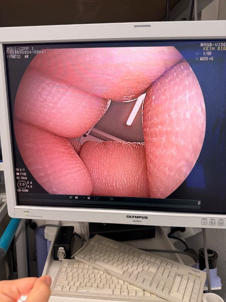 For Sale FUJINON EB-530H Bronchoscope thumbnail 4