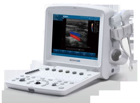 Edan U50 Cardiac and Vascular Ultrasound System