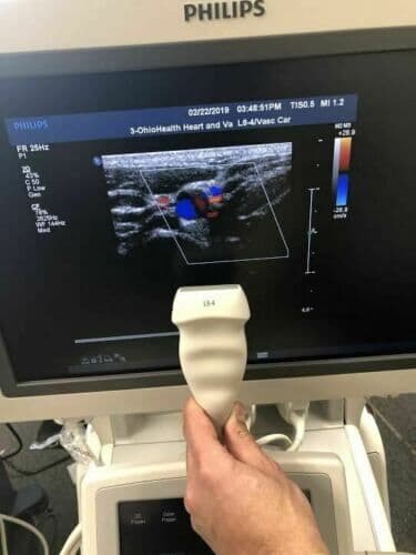 Philips L8-4 Linear Array Ultrasound Transducer Probe image 1