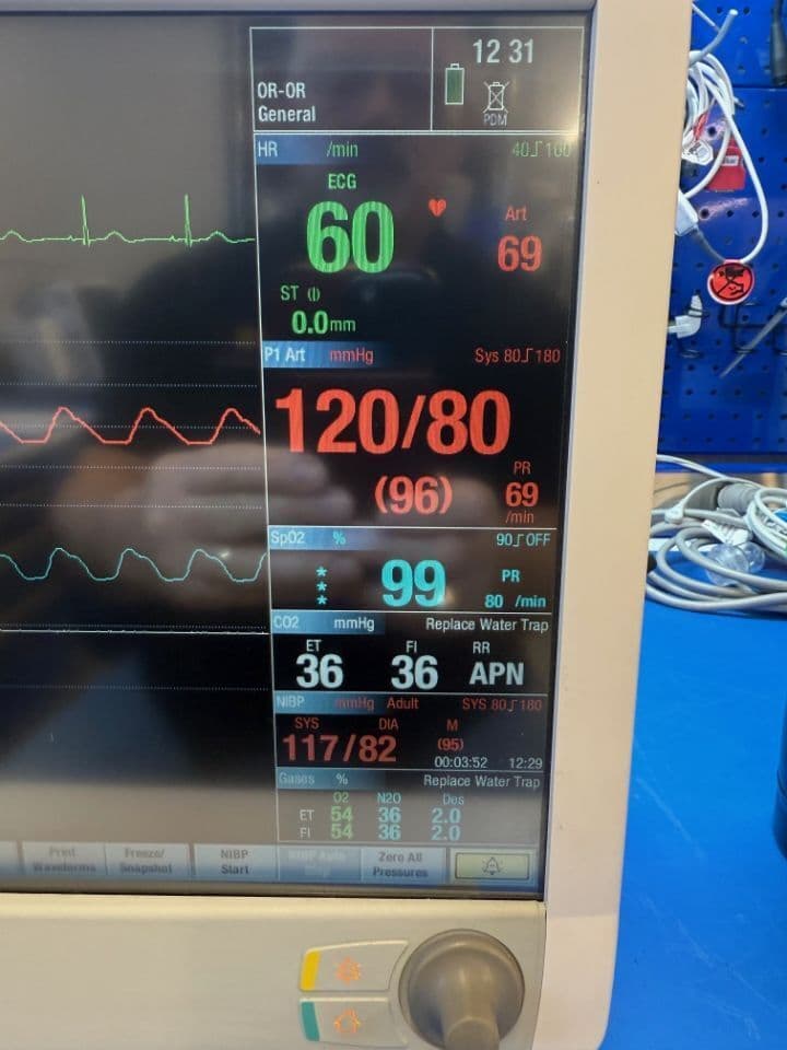 For Sale GE B650 Anesthesia Monitor Anesthesia Monitor thumbnail 5