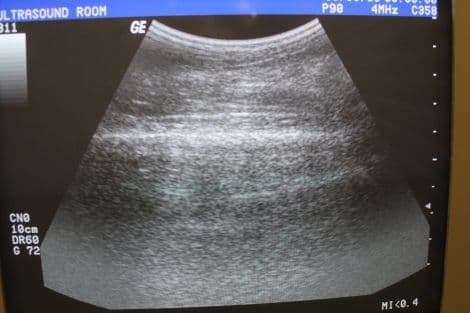 GE C358 Convex Ultrasound Transducer for Abdominal, Urology, and OB-GYN thumbnail 4