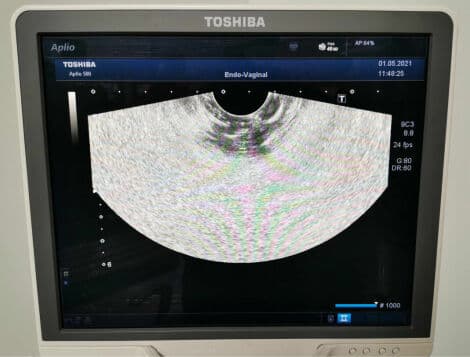 Endovaginal Ultrasound Transducer — Toshiba PVT-661VT thumbnail 7