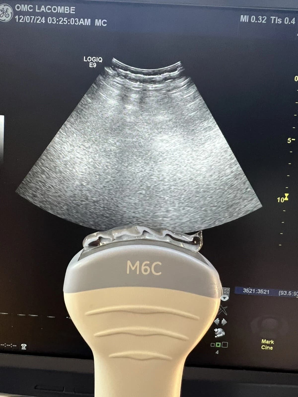 GE M6C Wideband Convex Array Ultrasound Probe for Voluson E6, E8 & Women's Health Imaging