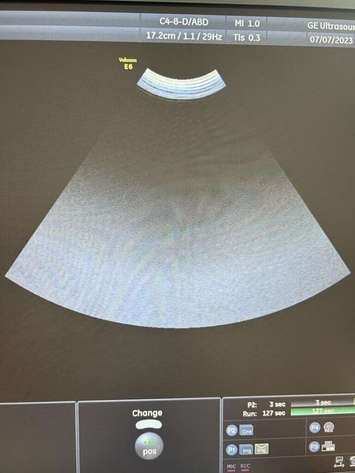 GE C4-8-D Micro Convex Ultrasound Transducer thumbnail 2