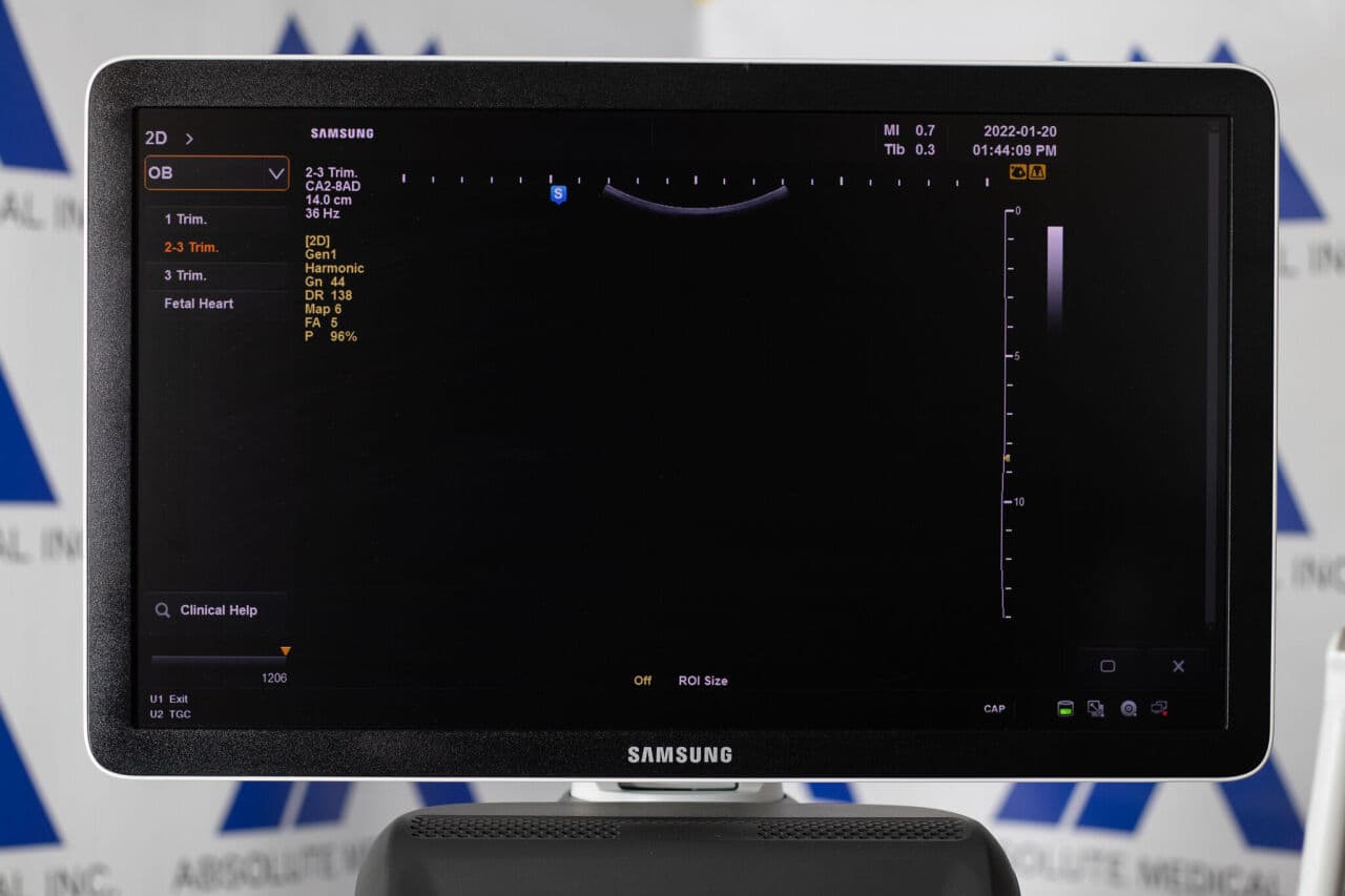 Samsung HS50 Diagnostic Ultrasound System thumbnail 3