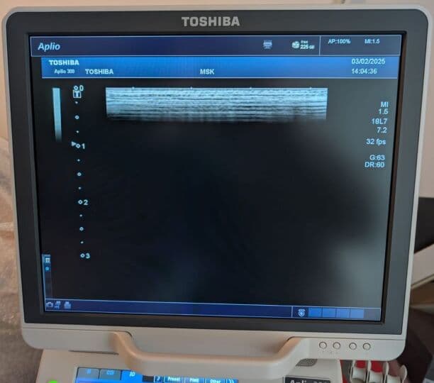 Toshiba PLT-1204BT Linear Ultrasound Transducer thumbnail 7