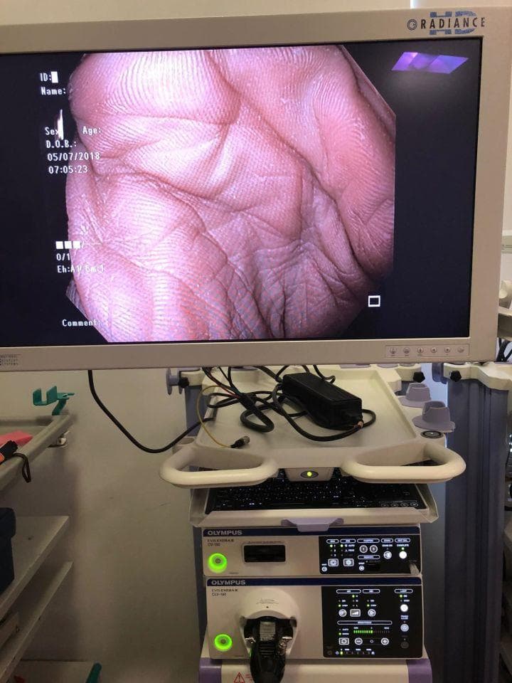 OLYMPUS CV-190 & CLV-190 — EVIS EXERA III Endoscopy System thumbnail 4