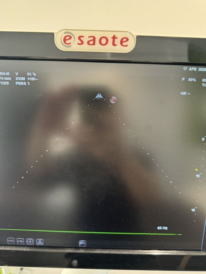 For Sale ESAOTE MyLab Seven Cardiac - Vascular Ultrasound thumbnail 2