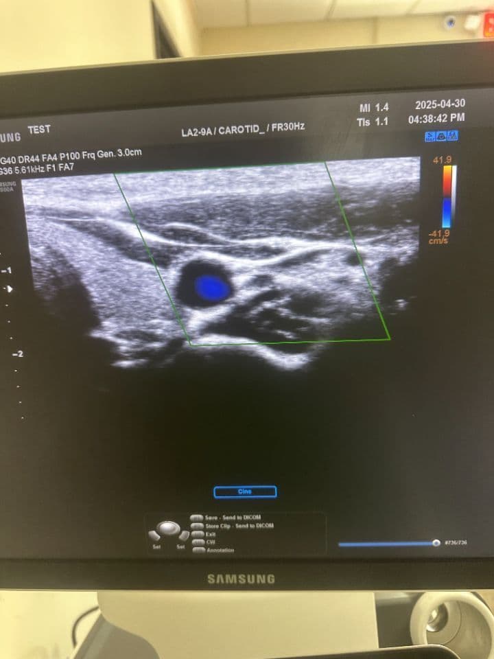 Samsung RS80A Diagnostic Ultrasound System thumbnail 10