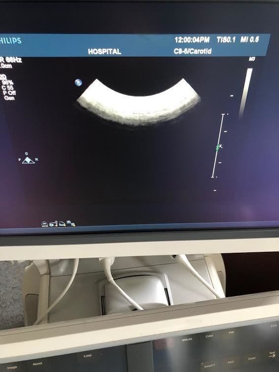 Philips C8-5 Micro Convex Ultrasound Transducer thumbnail 2
