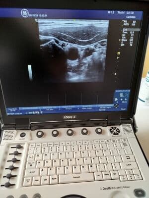 GE Logiq E Portable Ultrasound System thumbnail 8