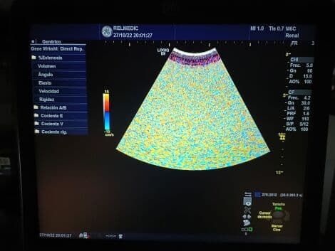 GE M6C-D Matrix Convex Ultrasound Transducer thumbnail 7