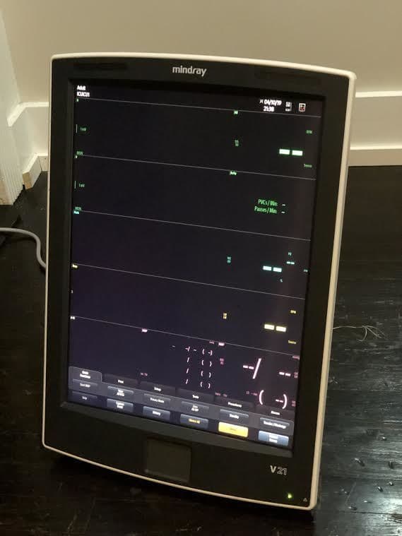 Mindray V21 Patient Monitor thumbnail 3