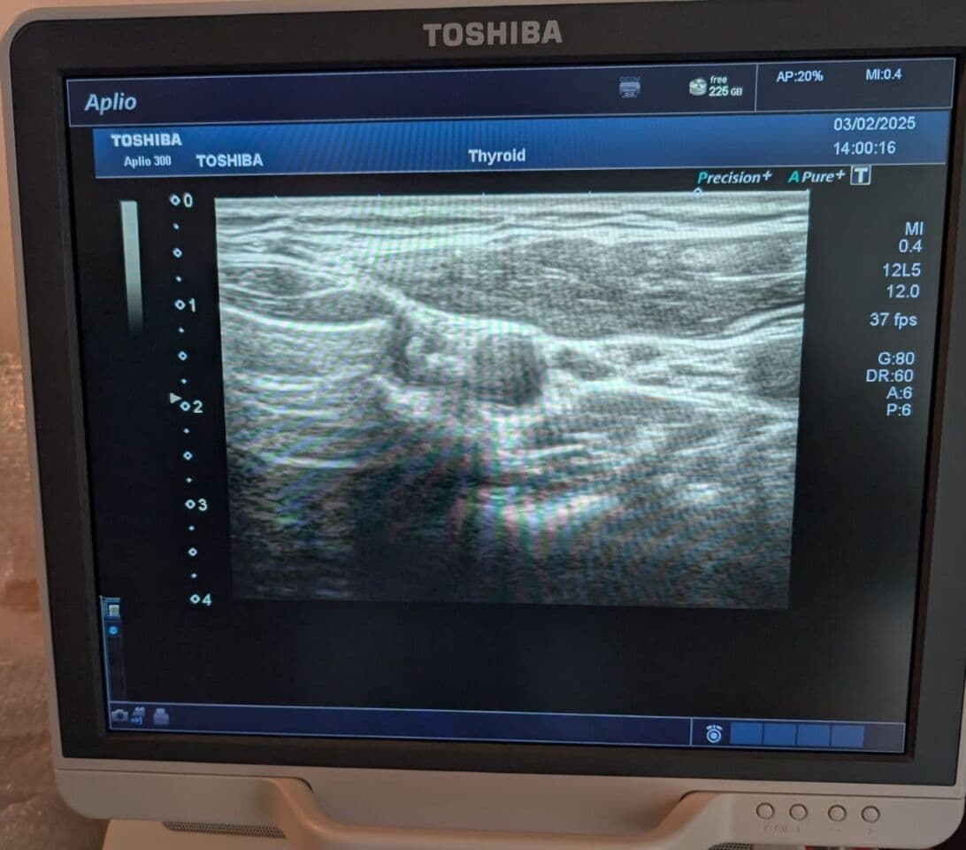 Toshiba PLT-805AT Linear Ultrasound Transducer for Aplio, Xario, and Viamo Systems thumbnail 6