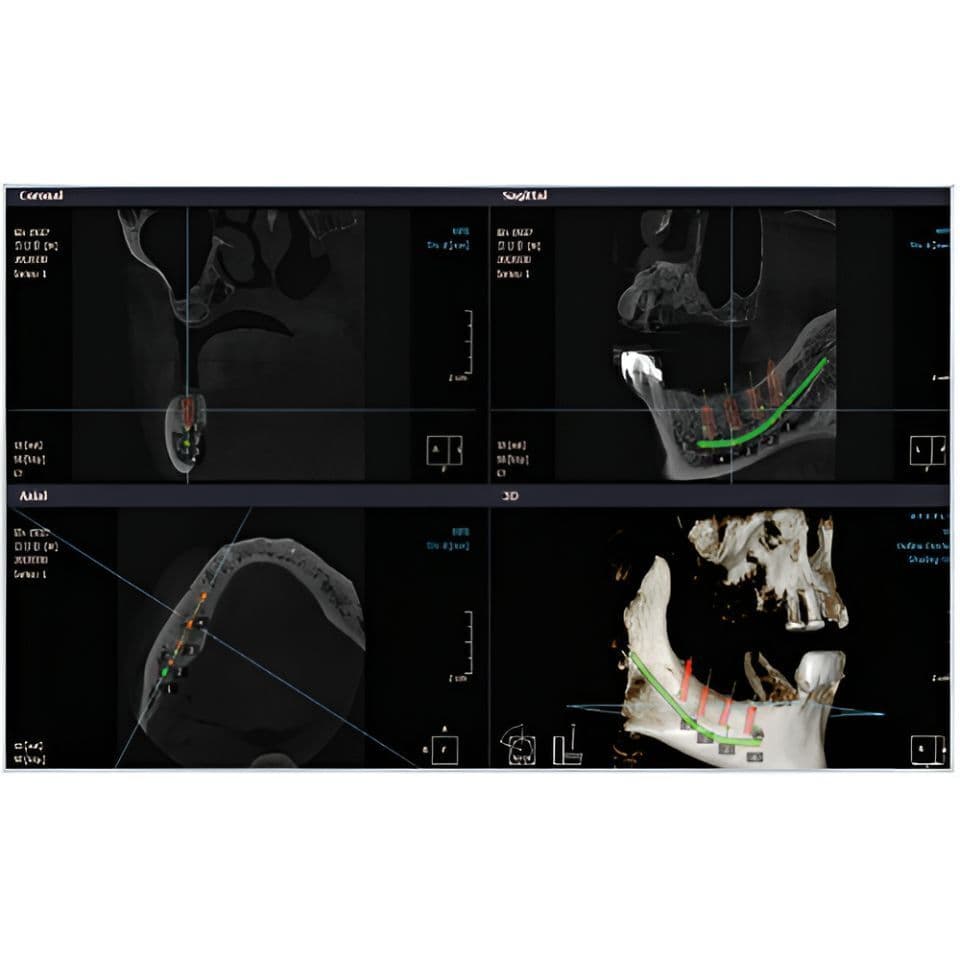 RAYSCAN Alpha Pan + CBCT (10x10 FOV) 3D Dental X-Ray System thumbnail 5