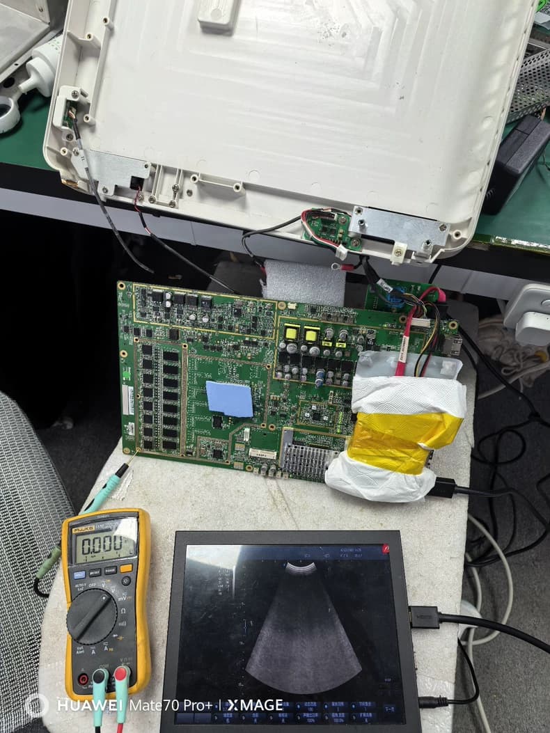 SonoScape E1 EXP Portable Ultrasound Repair Service (Probe Not Recognized / Image Interference / Weak Echo / Low Image Quality / Signal Noise)