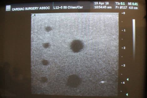 ATL L12-5 Linear Ultrasound Transducer for Small Parts and Vascular Applications thumbnail 3