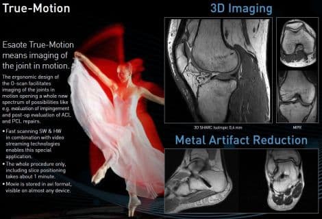 Office-Ready Esaote O-Scan Extremity MRI Scanner thumbnail 5