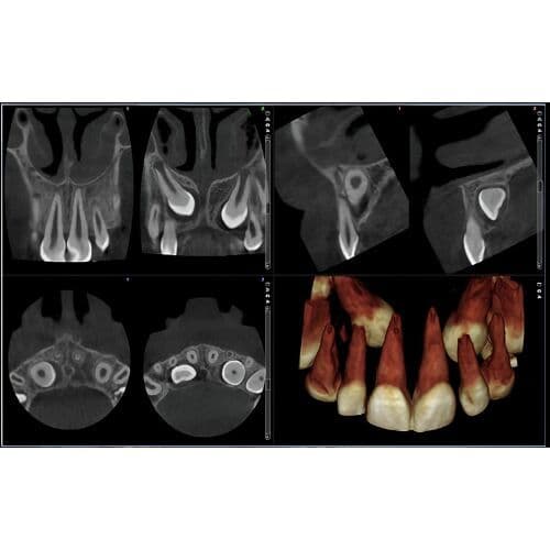 Planmeca Pan + CBCT (8x8 FOV) 3D Dental X-Ray System thumbnail 8