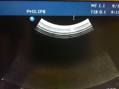 Philips C5-1 Curved Array Ultrasound Transducer thumbnail 5