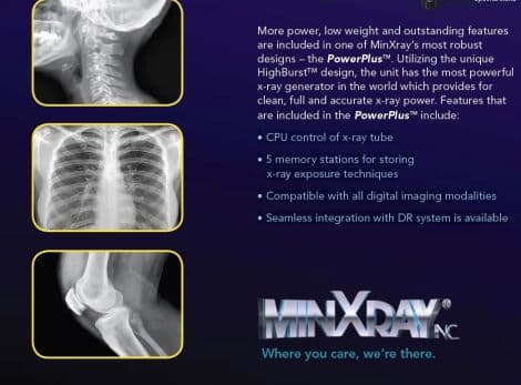 High-Power MinXray HF 120/60HPPWV PowerPlus Portable X-Ray System thumbnail 2