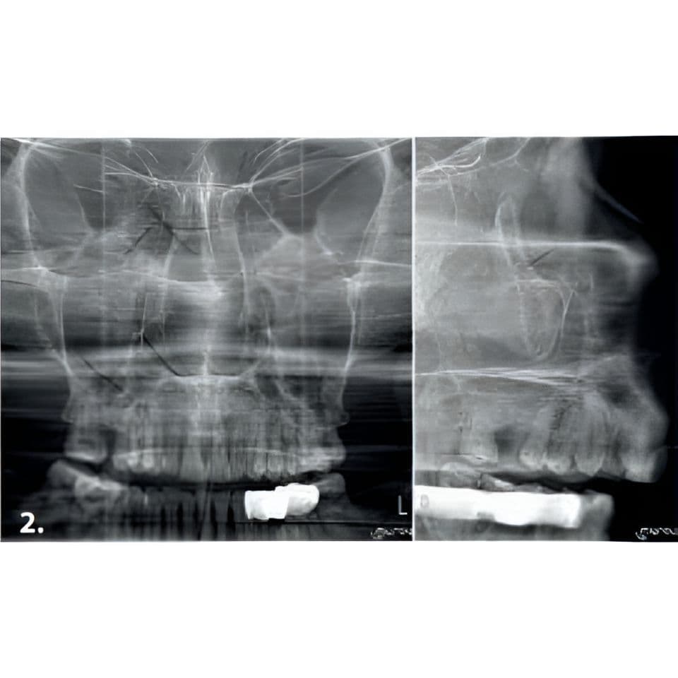 MyRay Hyperion X9 PRO Pan/Ceph/CBCT Dental X-Ray with 13x16 FOV thumbnail 8