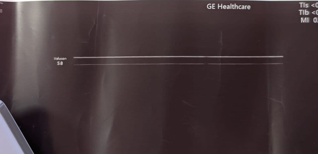 GE 12L-RS Linear Array Ultrasound Transducer thumbnail 5