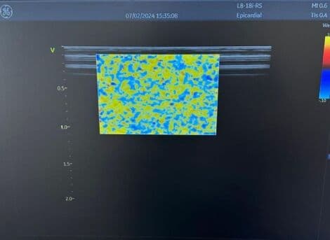 High-Frequency Linear Ultrasound Probe — GE L8-18i-RS for Vascular and Small Parts thumbnail 4