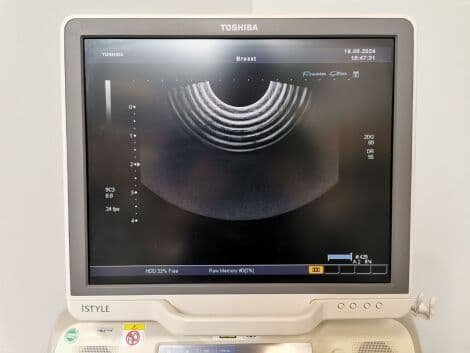 Diagnostic General Ultrasound System — Toshiba Aplio XG (SSA-780A) thumbnail 4