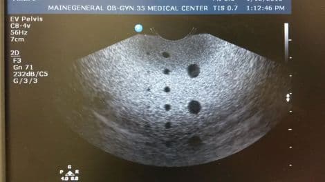 Philips C8-4v Endovaginal Curved Array Ultrasound Transducer thumbnail 4