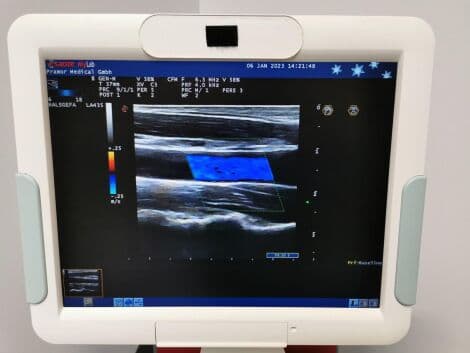 General Ultrasound System by Esaote — Mylab 60 with LA435, LA522E, and CA631 Probes thumbnail 7