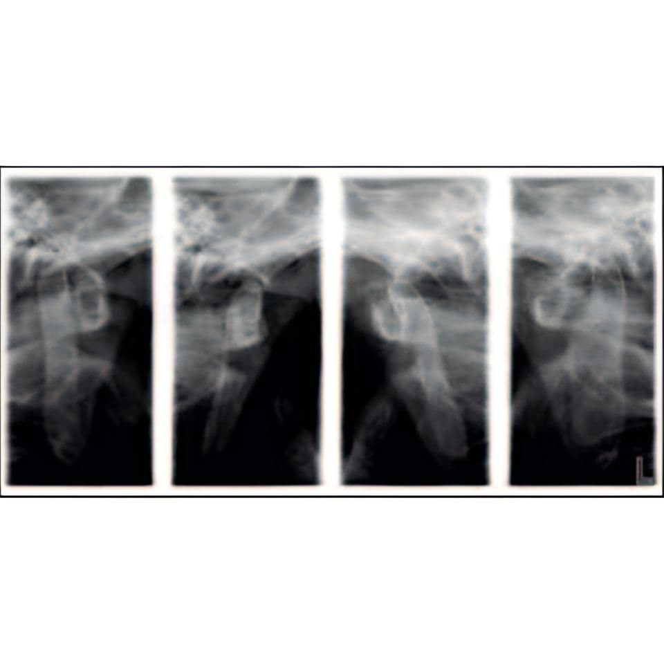 Planmeca ProMax Pan Dental X-Ray System thumbnail 11