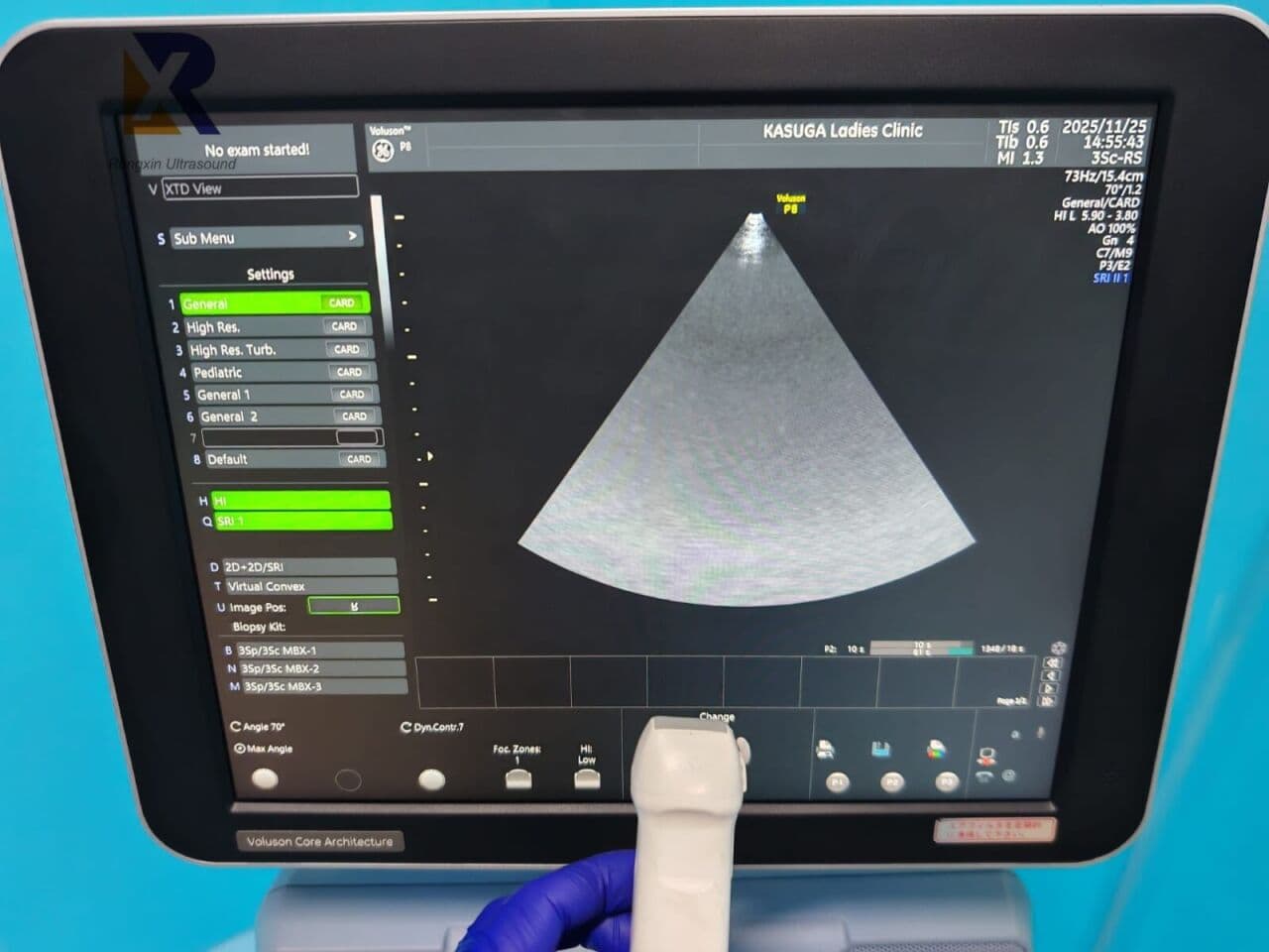 GE Voluson P8 BT16/BT18 OB/GYN Ultrasound System thumbnail 3