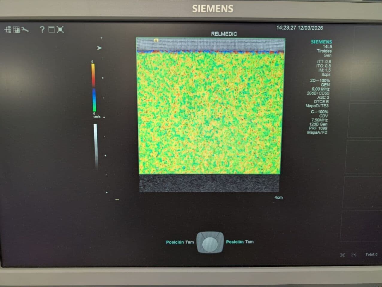 Siemens 14L5 Linear Ultrasound Transducer thumbnail 6