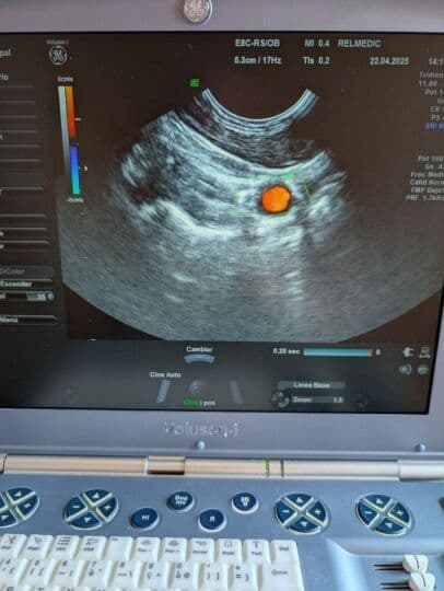 GE Voluson i Portable OB/GYN Ultrasound System thumbnail 9