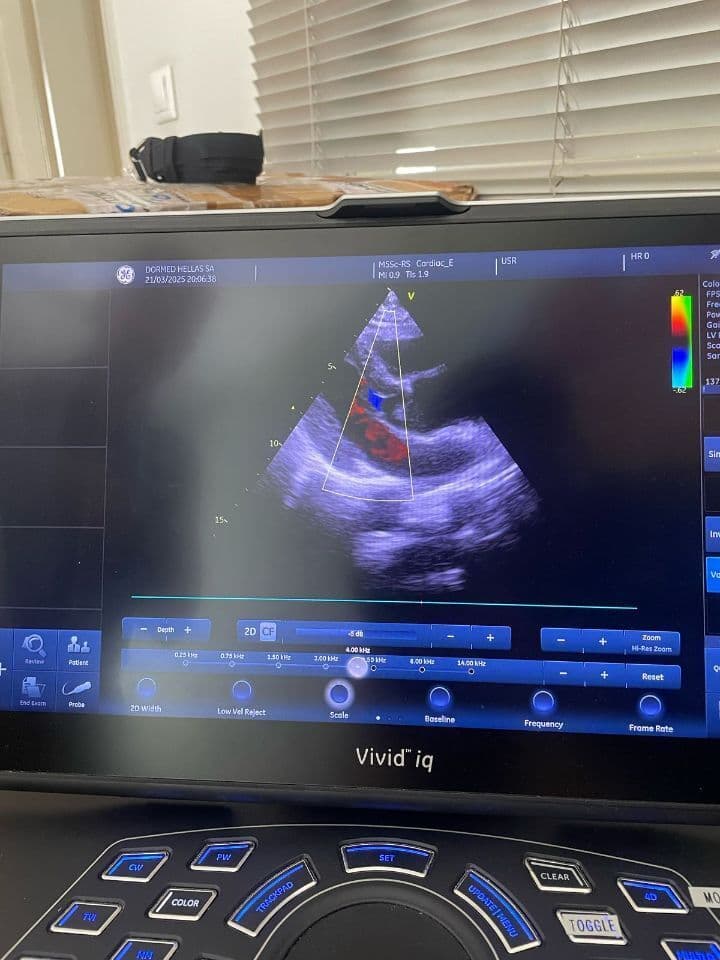 For Sale GE HEALTHCARE Vivid iq Ultrasound System thumbnail 3