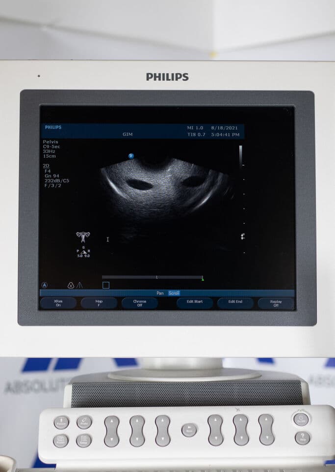 Philips HD11xe Ultrasound System thumbnail 13