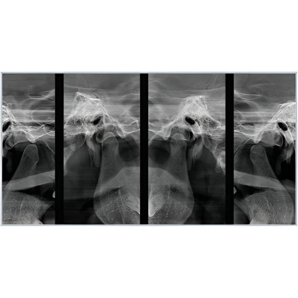 RAYSCAN Alpha Pan + CBCT (10x10 FOV) 3D Dental X-Ray System thumbnail 8